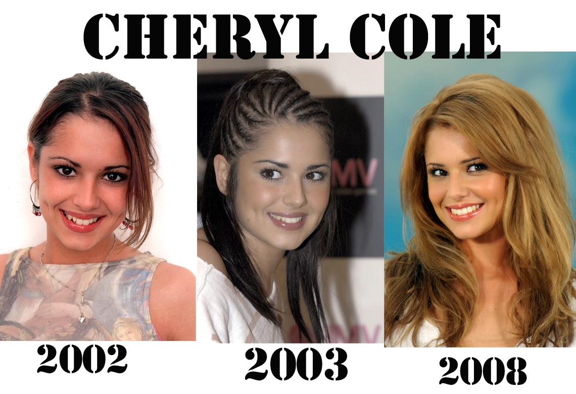 Cheryl Cole Plastic Surgery