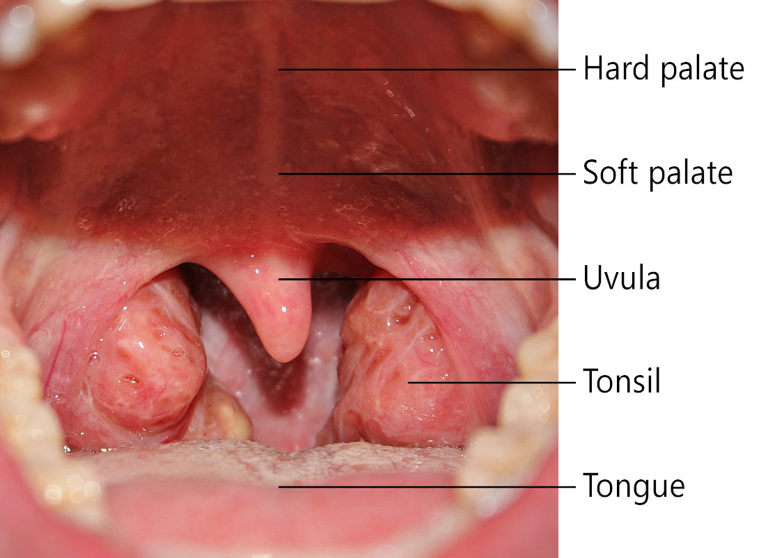 File:Throat with Tonsils