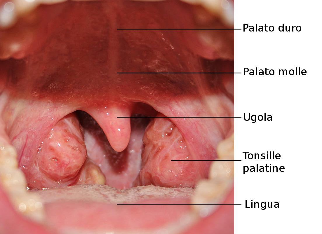 File:Throat with Tonsils-IT.